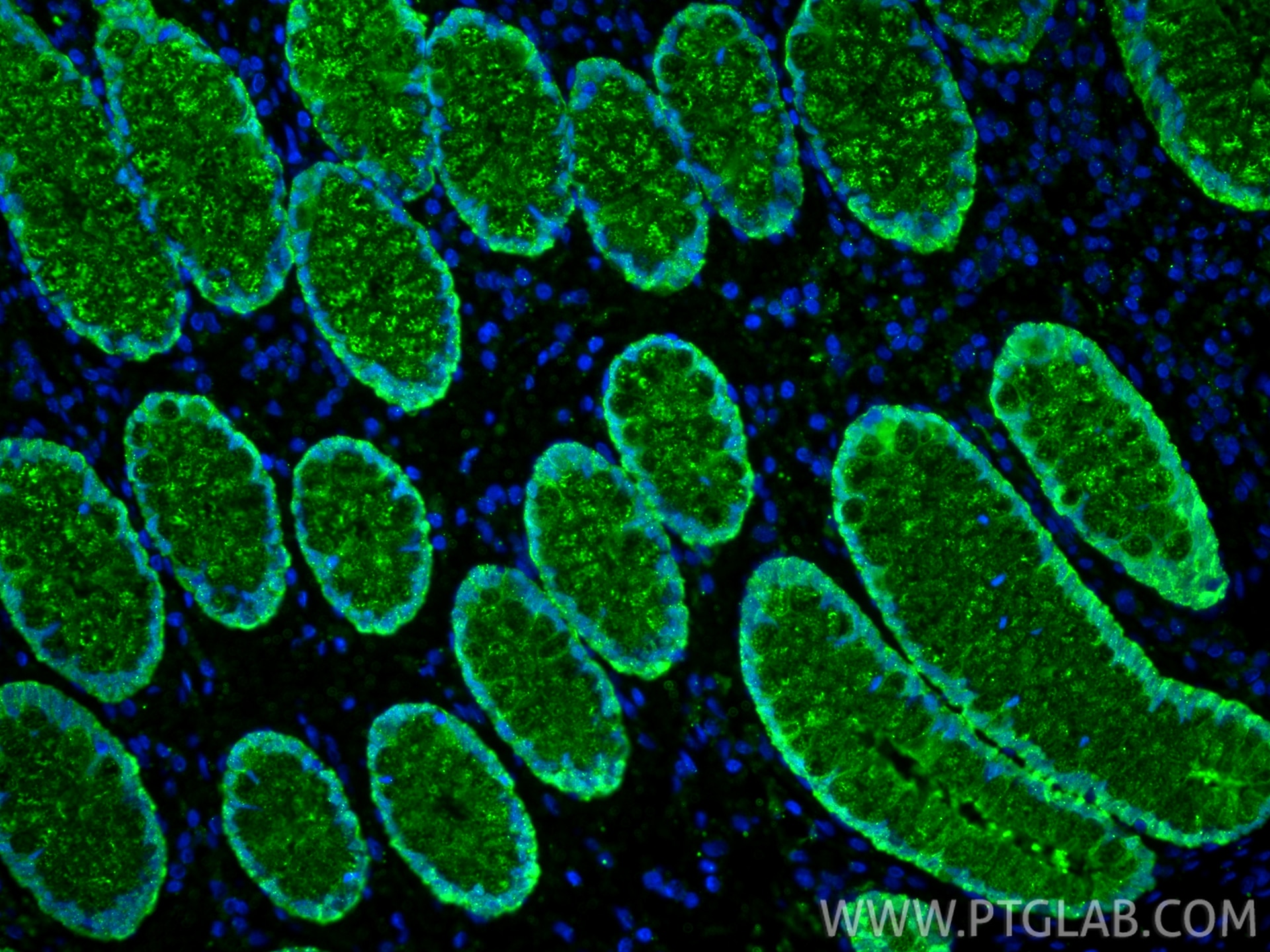 Immunofluorescence (IF) / fluorescent staining of human large intestine tissue using Galectin-4 Monoclonal antibody (66686-1-Ig)