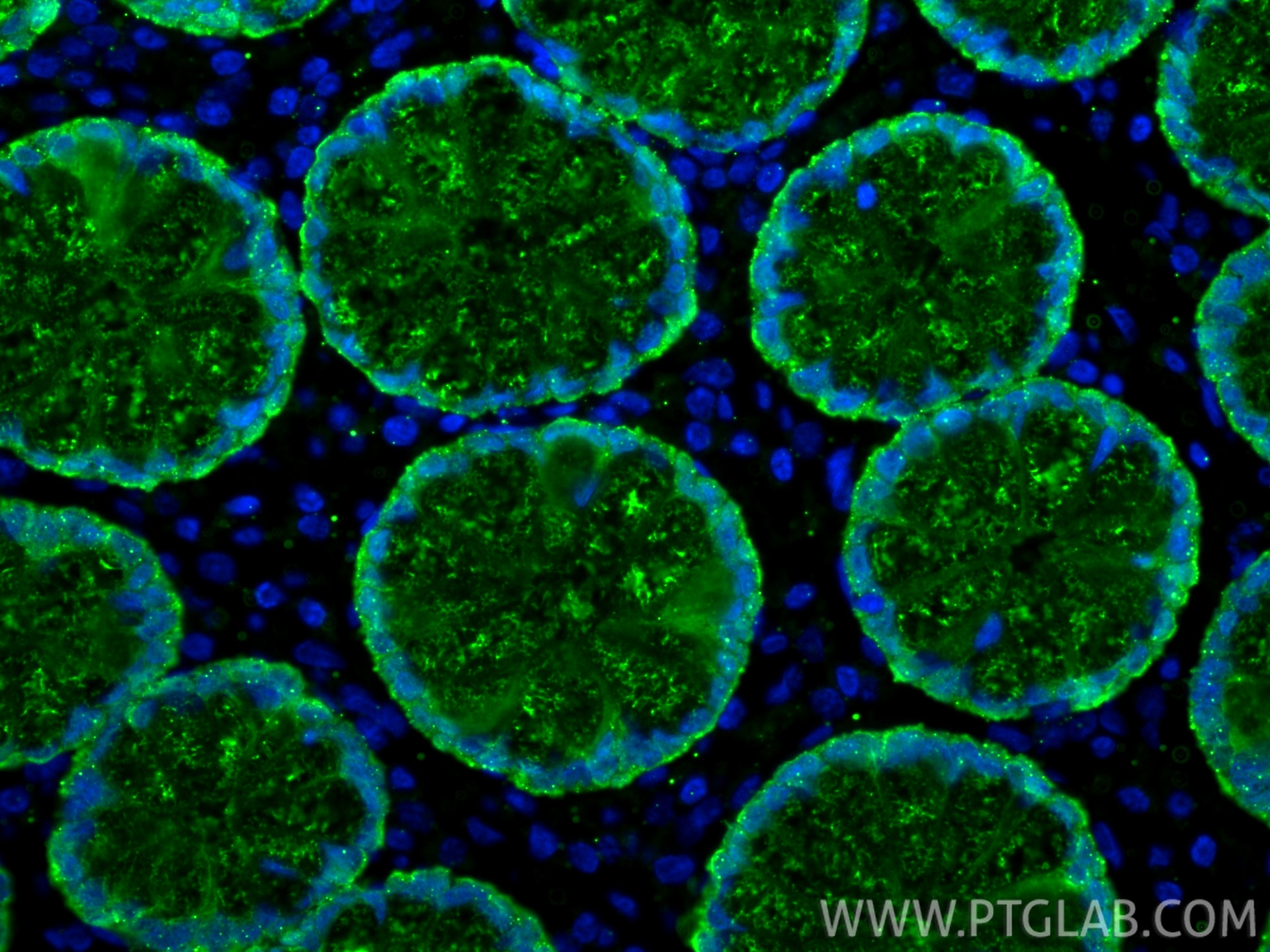 Immunofluorescence (IF) / fluorescent staining of human large intestine tissue using Galectin-4 Monoclonal antibody (66686-1-Ig)