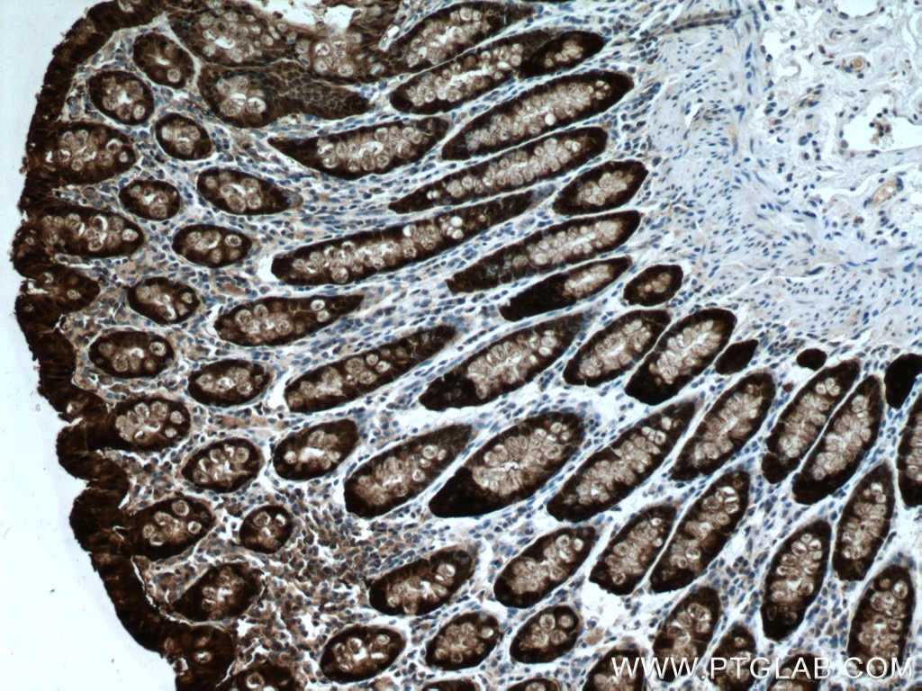 Immunohistochemistry (IHC) staining of human colon tissue using Galectin-4 Monoclonal antibody (66686-1-Ig)