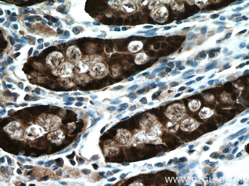 Immunohistochemistry (IHC) staining of human colon tissue using Galectin-4 Monoclonal antibody (66686-1-Ig)