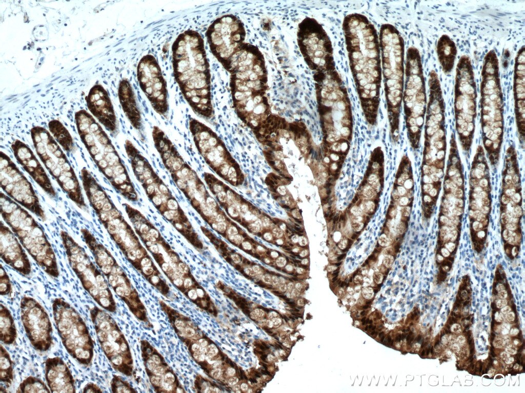 IHC staining of human colon using 66686-1-Ig