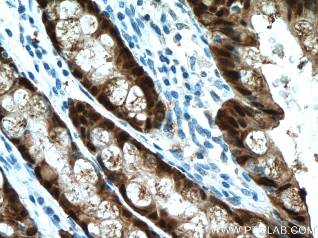 Immunohistochemistry (IHC) staining of human colon tissue using Galectin-4 Monoclonal antibody (66686-1-Ig)