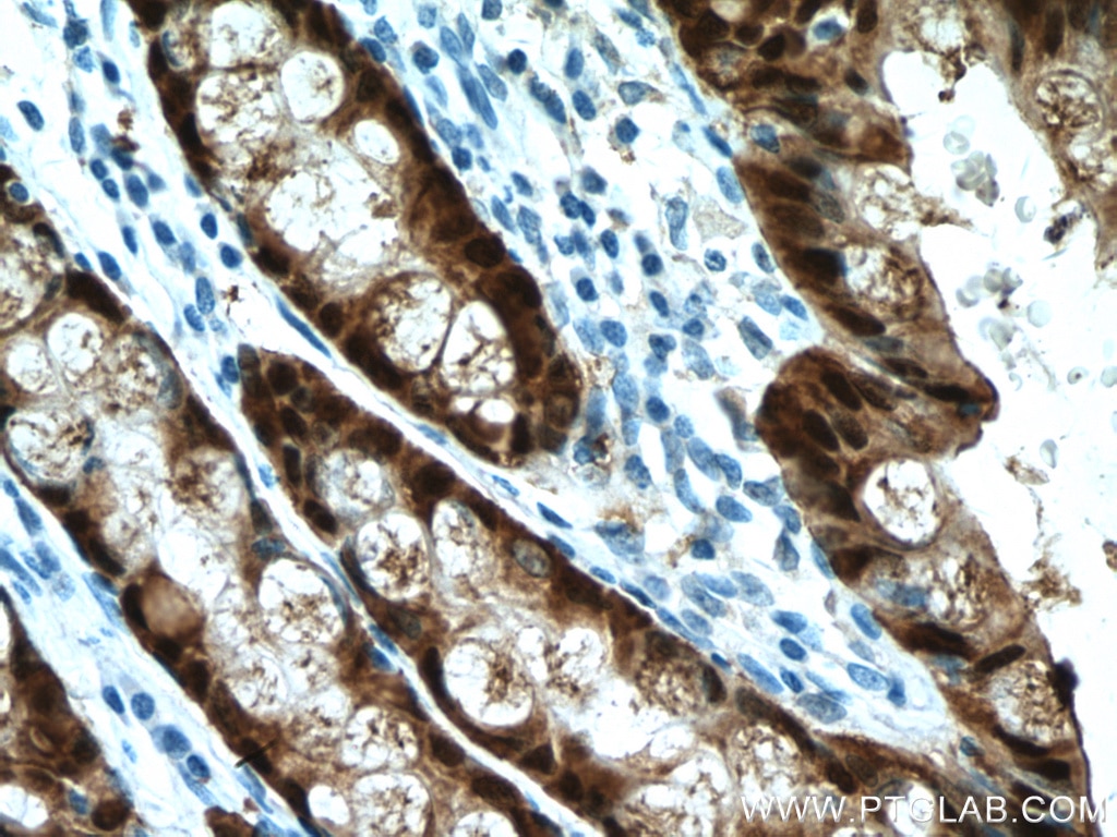 IHC staining of human colon using 66686-1-Ig