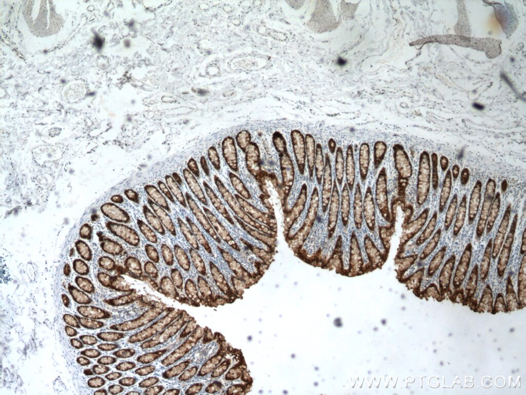 IHC staining of human colon using 66686-1-Ig