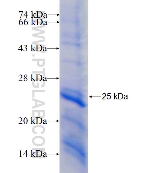 LGALS4,GAL4 fusion protein Ag26138 SDS-PAGE LGALS4,GAL4 fusion protein Ag26138 SDS-PAGE