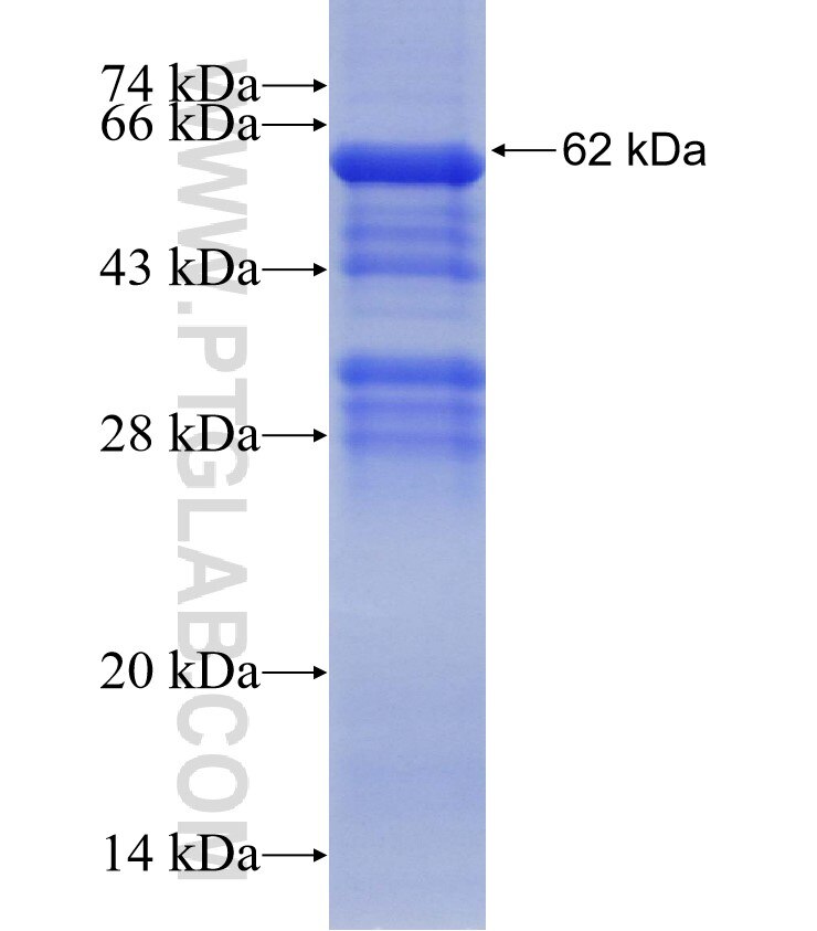 LGALS4,GAL4 fusion protein Ag4049 SDS-PAGE