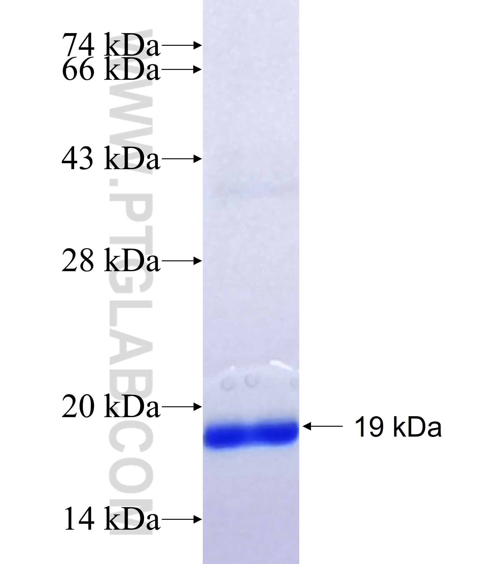 LGALS7 fusion protein Ag35901 SDS-PAGE LGALS7 fusion protein Ag35901 SDS-PAGE