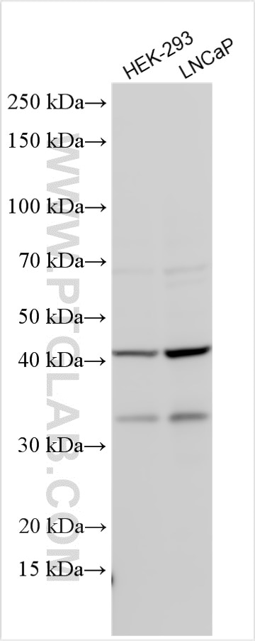 Western Blot (WB) analysis of various lysates using Galectin 8 Polyclonal antibody (10955-1-AP)