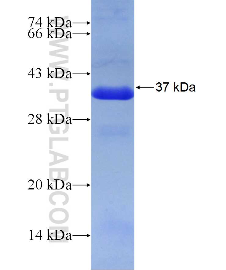 LGALS8 fusion protein Ag29869 SDS-PAGE