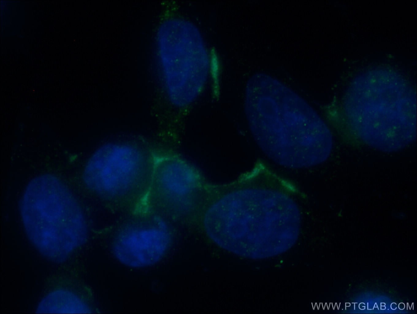 Immunofluorescence (IF) / fluorescent staining of HeLa cells using Galectin-9 Polyclonal antibody (17938-1-AP)
