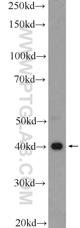 Western Blot (WB) analysis of SGC-7901 cells using Galectin-9 Polyclonal antibody (17938-1-AP)
