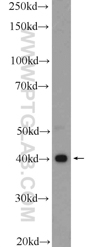 WB analysis of SGC-7901 using 17938-1-AP