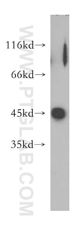 Western Blot (WB) analysis of HeLa cells using Galectin-9 Polyclonal antibody (17938-1-AP)