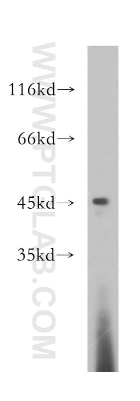 Western Blot (WB) analysis of HL-60 cells using Galectin-9 Polyclonal antibody (17938-1-AP)