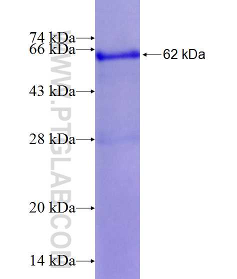 LGALS9, Galectin-9 fusion protein Ag12209 SDS-PAGE