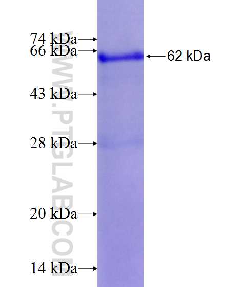 LGALS9, Galectin-9 fusion protein Ag12209 SDS-PAGE