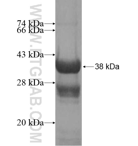 LGALS9, Galectin-9 fusion protein Ag13305 SDS-PAGE