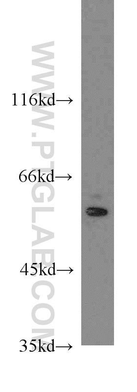 Western Blot (WB) analysis of HeLa cells using LGI1 Polyclonal antibody (12483-1-AP)