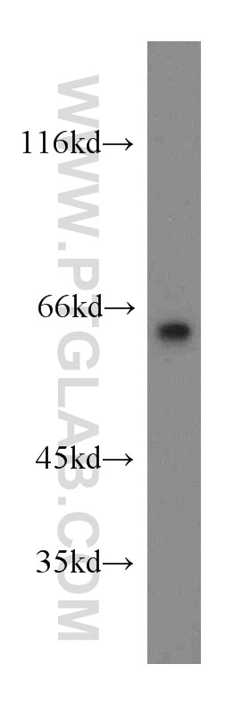 Western Blot (WB) analysis of human brain tissue using LGI1 Polyclonal antibody (12483-1-AP)