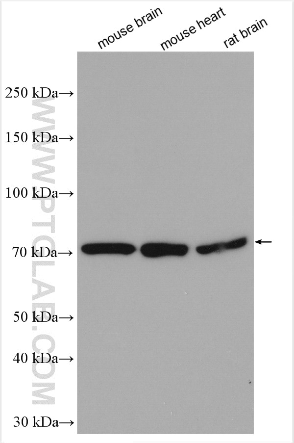 Western Blot (WB) analysis of various lysates using LGI2 Polyclonal antibody (18044-1-AP)