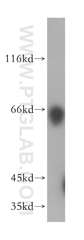 Western Blot (WB) analysis of mouse brain tissue using LGI2 Polyclonal antibody (18044-1-AP)