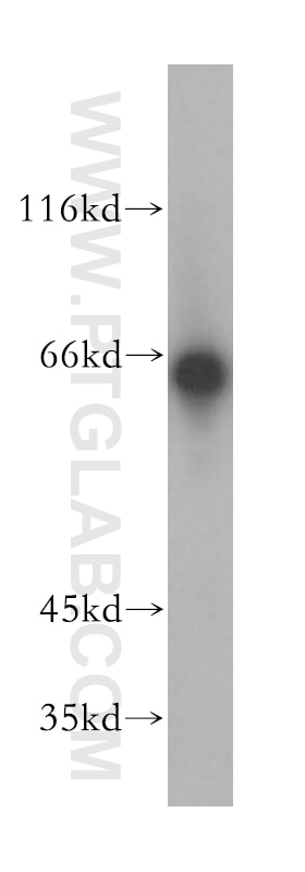 Western Blot (WB) analysis of mouse heart tissue using LGI2 Polyclonal antibody (18044-1-AP)