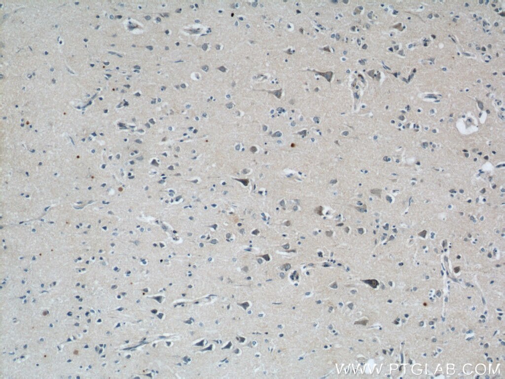 Immunohistochemistry (IHC) staining of human brain tissue using LGI3 Polyclonal antibody (21919-1-AP)