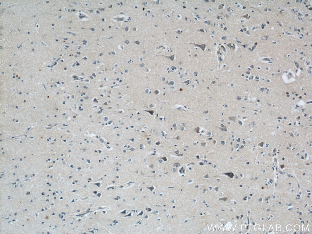 IHC staining of human brain using 21919-1-AP