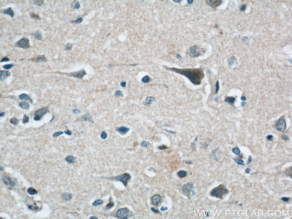 Immunohistochemistry (IHC) staining of human brain tissue using LGI3 Polyclonal antibody (21919-1-AP)