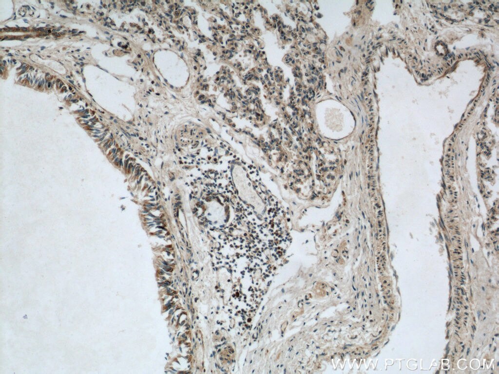 IHC staining of human lung using 21919-1-AP