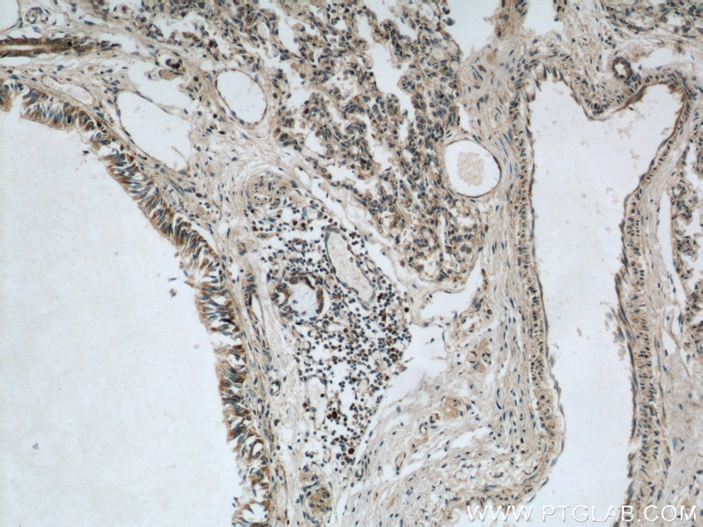 Immunohistochemistry (IHC) staining of human lung tissue using LGI3 Polyclonal antibody (21919-1-AP)