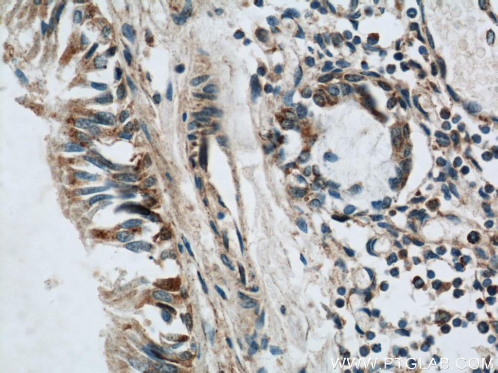 Immunohistochemistry (IHC) staining of human lung tissue using LGI3 Polyclonal antibody (21919-1-AP)