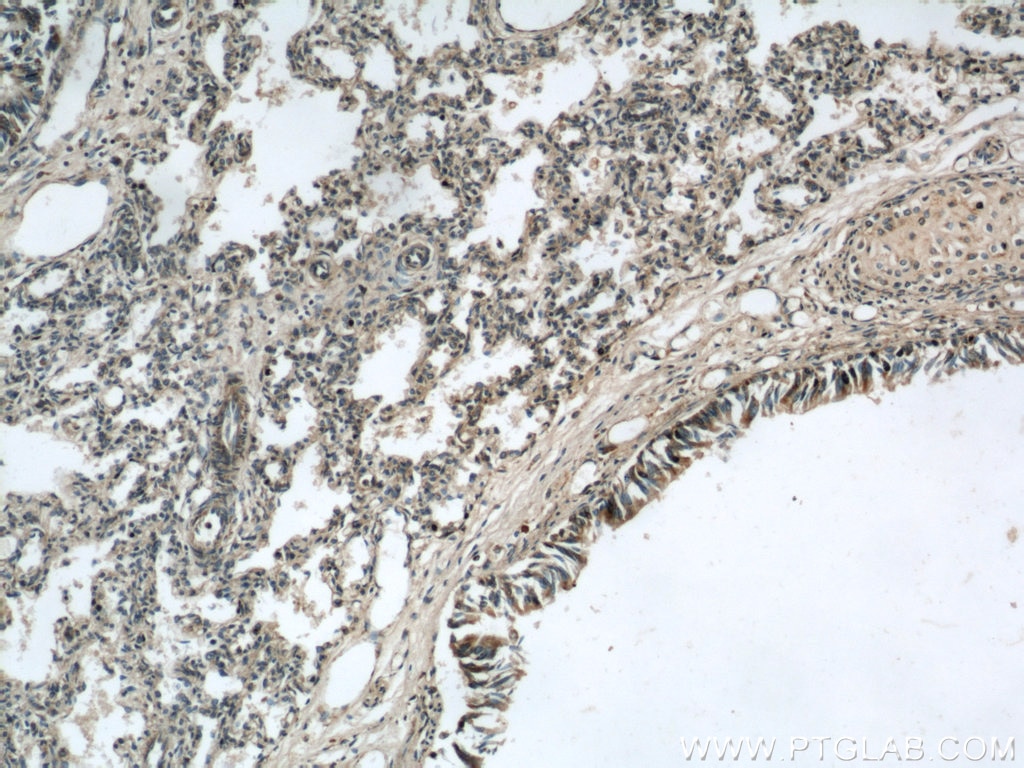 Immunohistochemistry (IHC) staining of human lung tissue using LGI3 Polyclonal antibody (21919-1-AP)