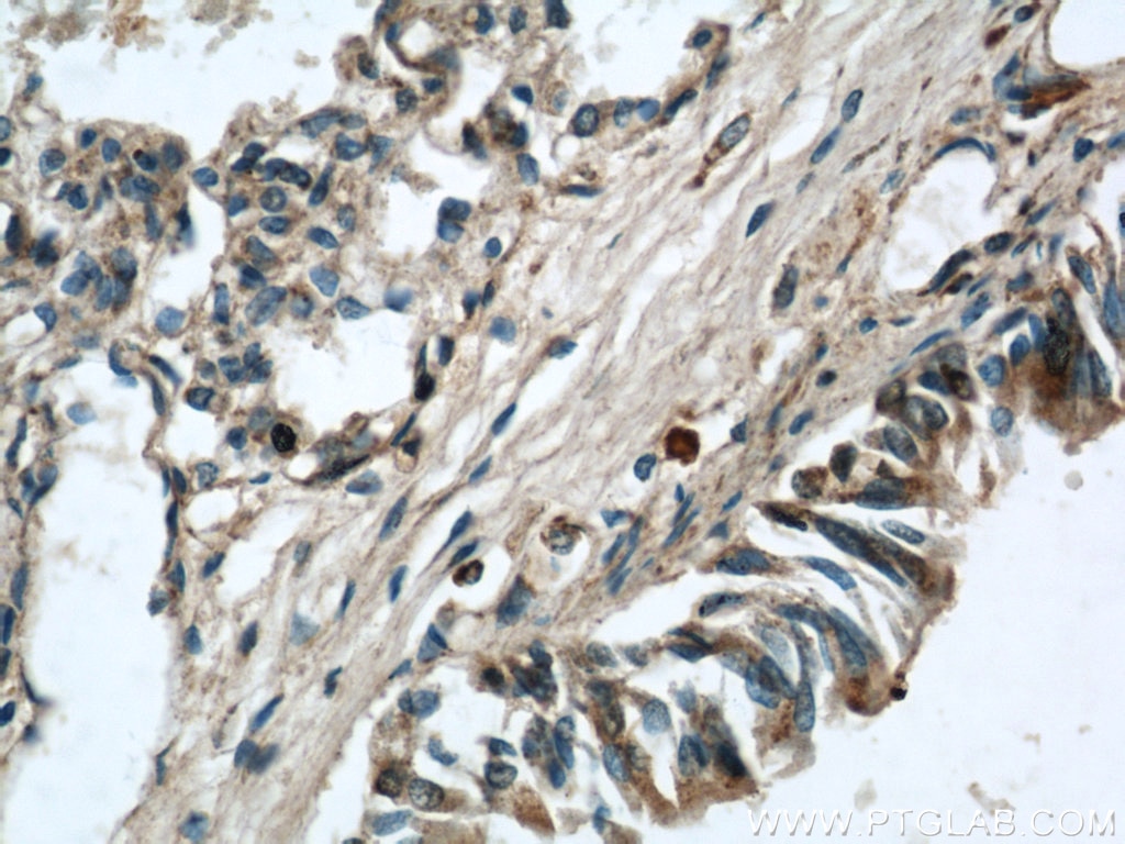 Immunohistochemistry (IHC) staining of human lung tissue using LGI3 Polyclonal antibody (21919-1-AP)
