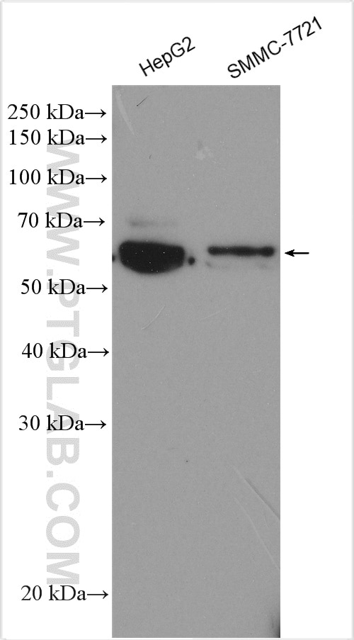 Western Blot (WB) analysis of various lysates using LGI3 Polyclonal antibody (21919-1-AP)