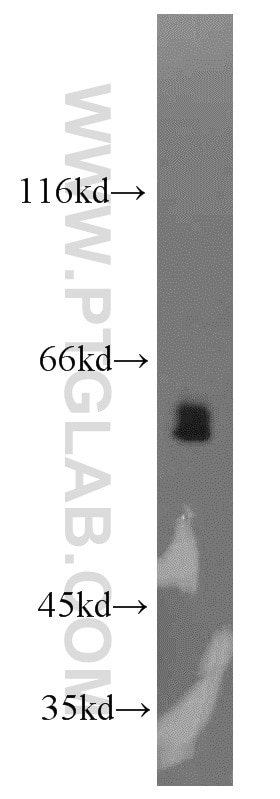 WB analysis of mouse lung using 21919-1-AP