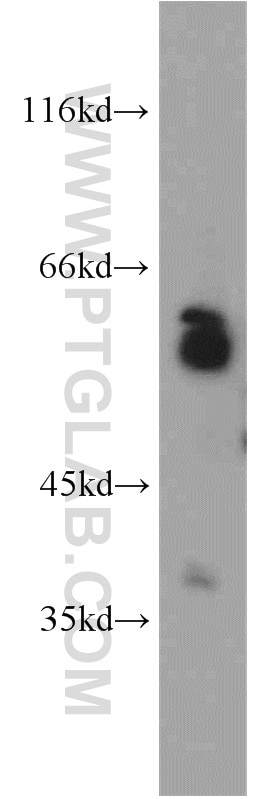 Western Blot (WB) analysis of A549 cells using LGI3 Polyclonal antibody (21919-1-AP)