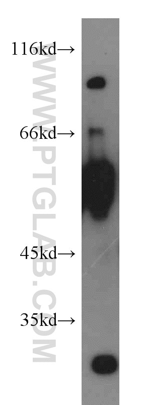 Western Blot (WB) analysis of mouse liver tissue using LGI3 Polyclonal antibody (21919-1-AP)