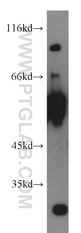 Western Blot (WB) analysis of mouse liver tissue using LGI3 Polyclonal antibody (21919-1-AP)