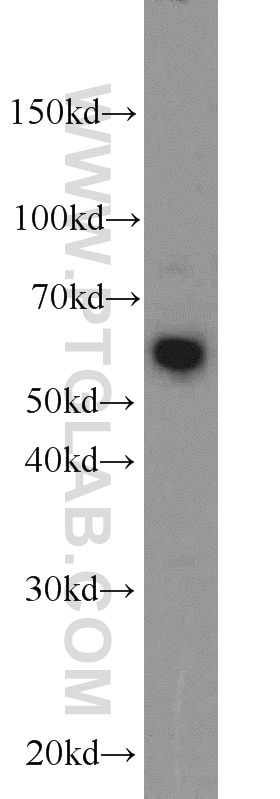 Western Blot (WB) analysis of HepG2 cells using LGI3 Polyclonal antibody (21919-1-AP)
