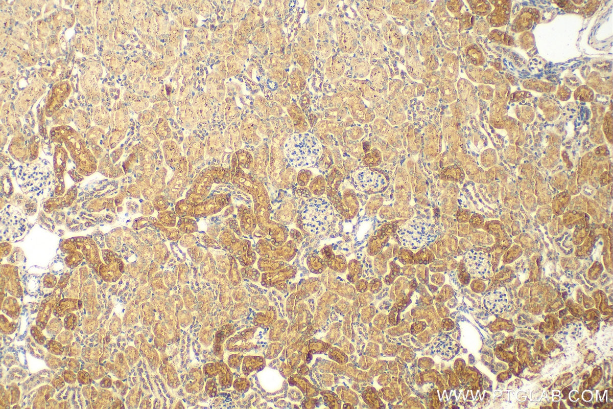 Immunohistochemistry (IHC) staining of mouse kidney tissue using LGMN Polyclonal antibody (15095-1-AP)