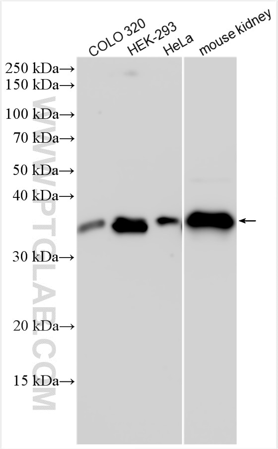 Western Blot (WB) analysis of various lysates using LGMN Polyclonal antibody (15095-1-AP)
