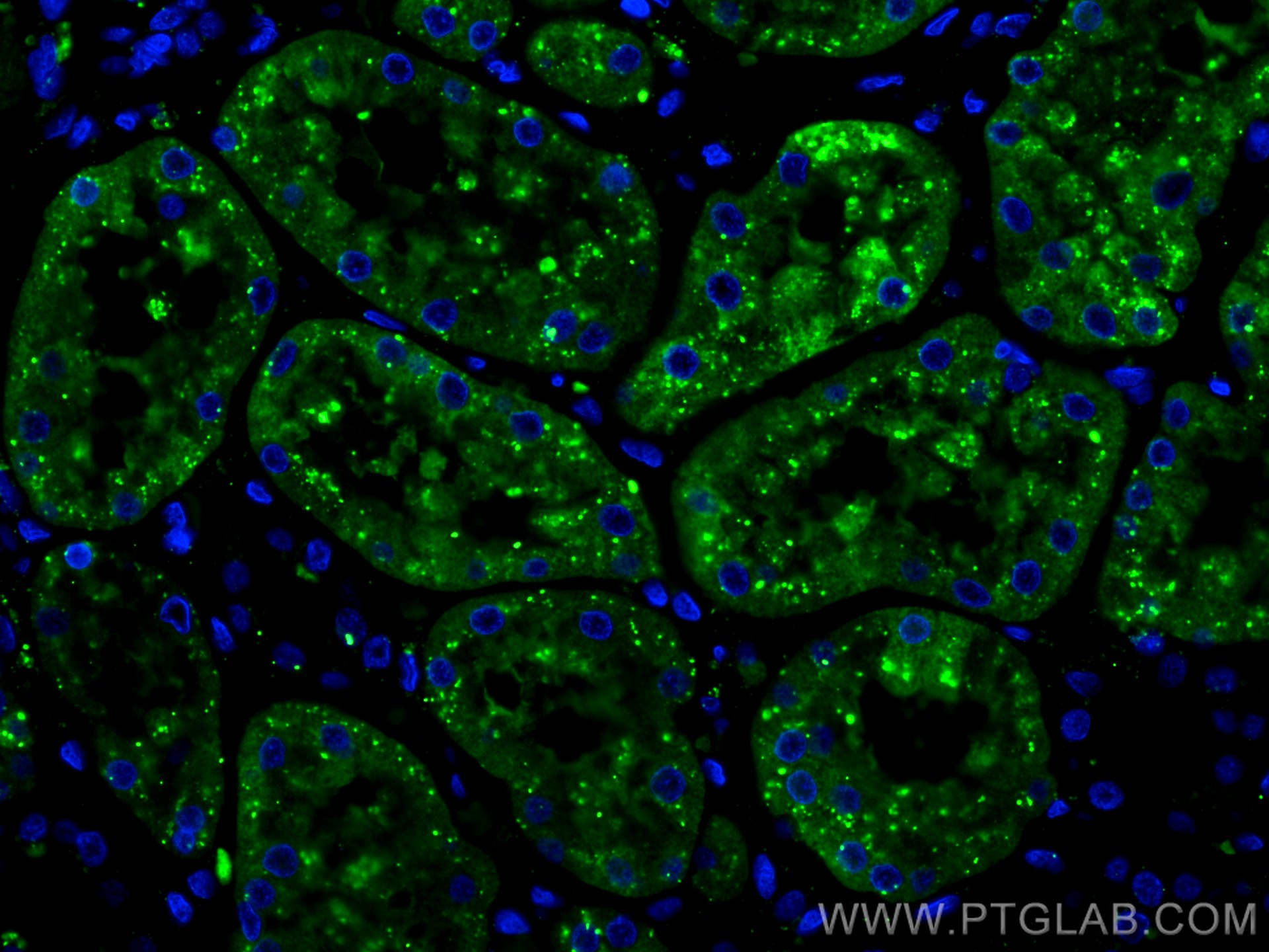 Immunofluorescence (IF) / fluorescent staining of human kidney tissue using LGMN Monoclonal antibody (67017-1-Ig)