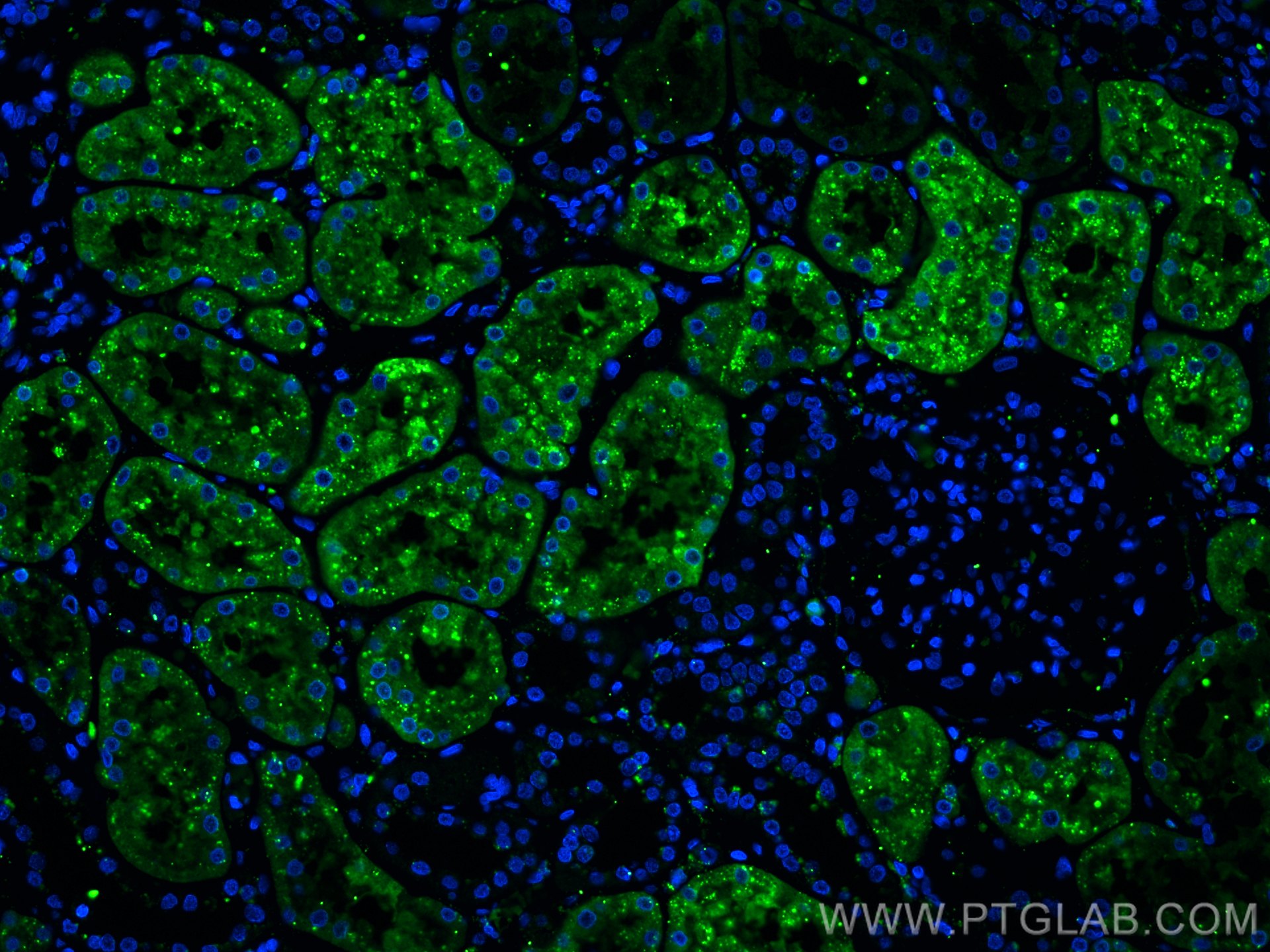 IF Staining of human kidney using 67017-1-Ig