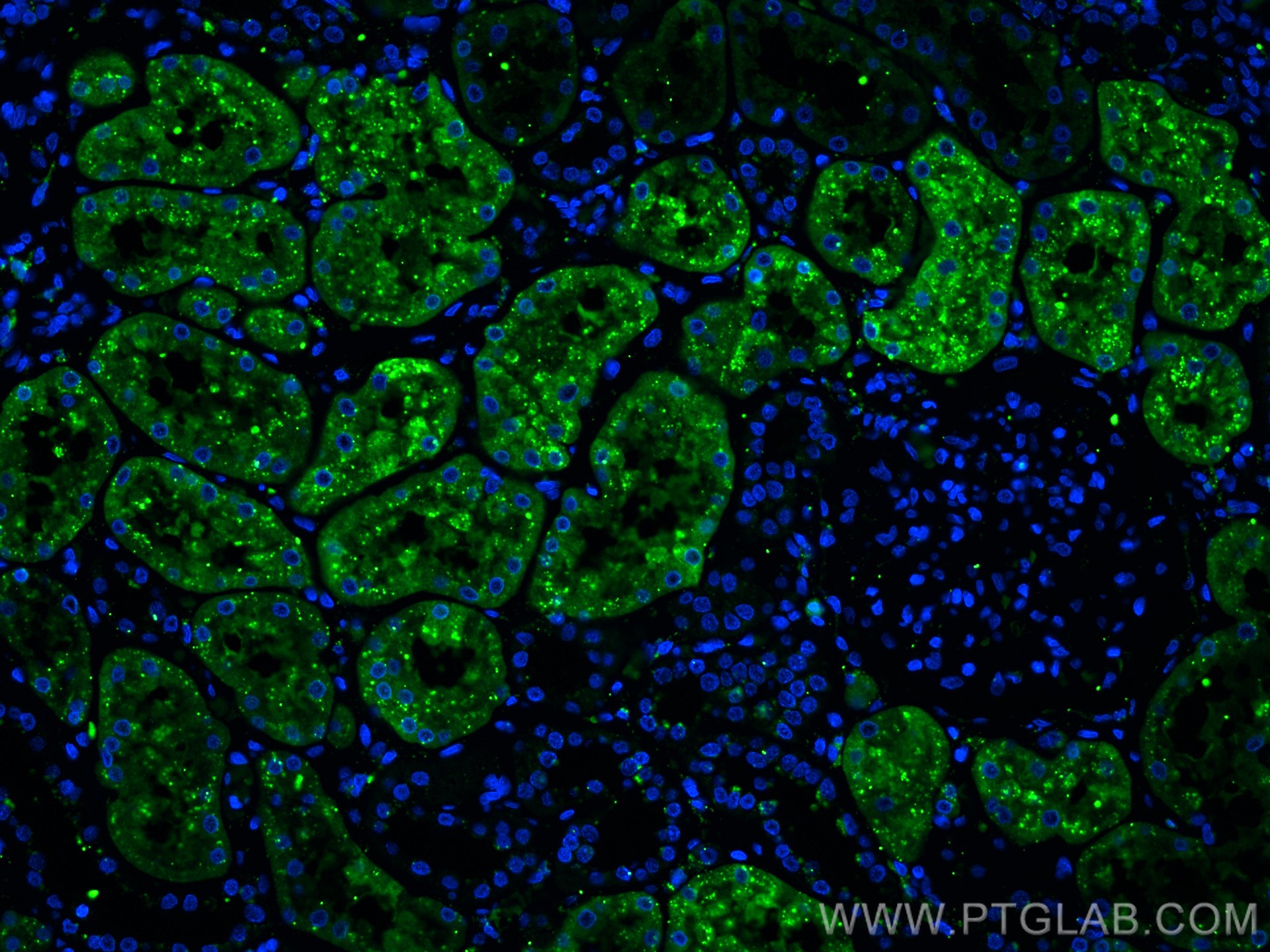 Immunofluorescence (IF) / fluorescent staining of human kidney tissue using LGMN Monoclonal antibody (67017-1-Ig)