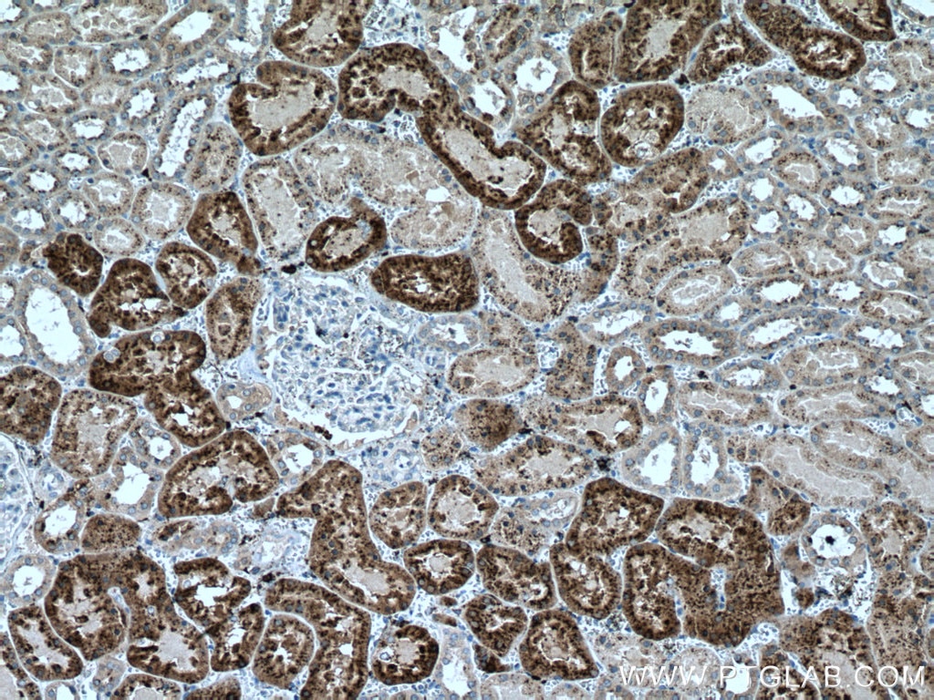 Immunohistochemistry (IHC) staining of human kidney tissue using LGMN Monoclonal antibody (67017-1-Ig)