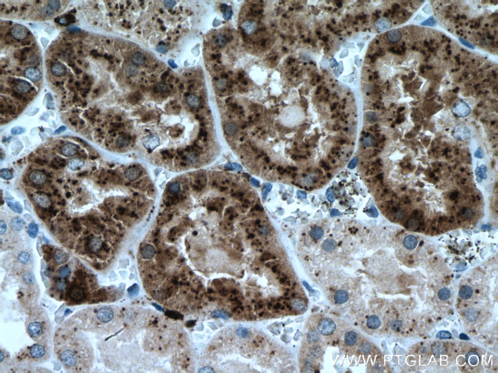 Immunohistochemistry (IHC) staining of human kidney tissue using LGMN Monoclonal antibody (67017-1-Ig)
