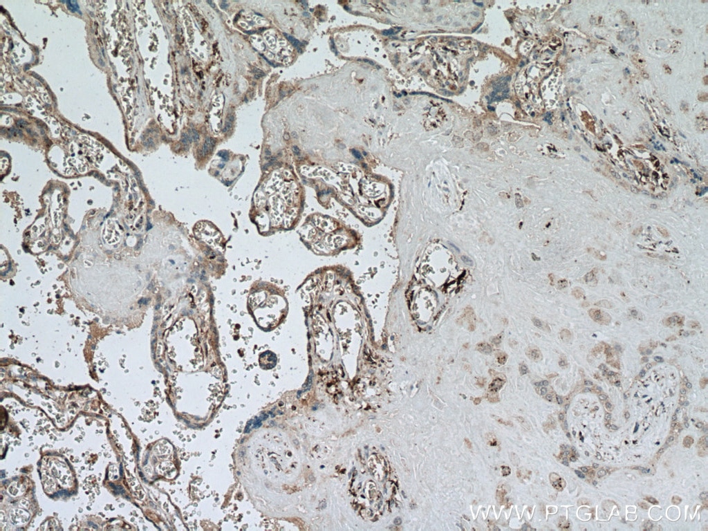 Immunohistochemistry (IHC) staining of human placenta tissue using LGMN Monoclonal antibody (67017-1-Ig)