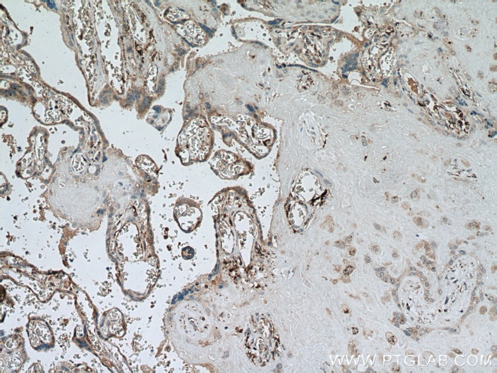 IHC staining of human placenta using 67017-1-Ig