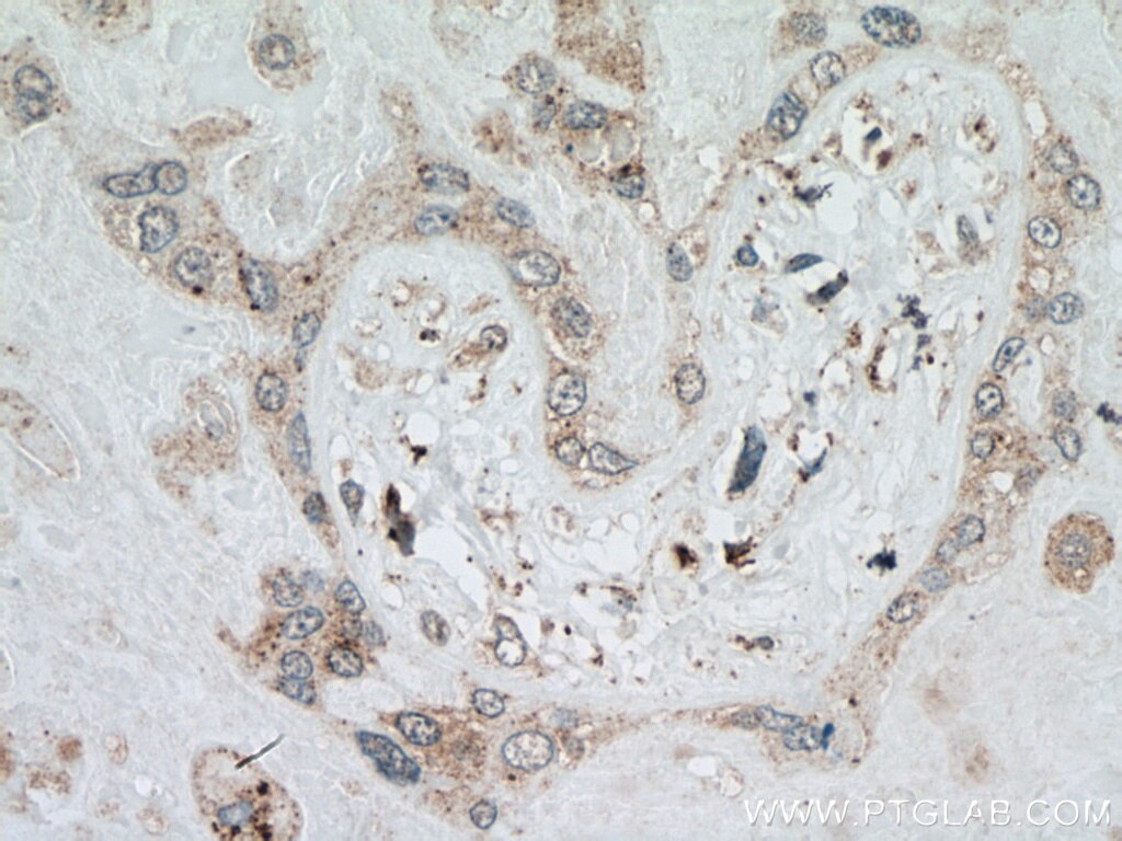 Immunohistochemistry (IHC) staining of human placenta tissue using LGMN Monoclonal antibody (67017-1-Ig)